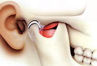 Tratamiento de la articulación temporomandibular